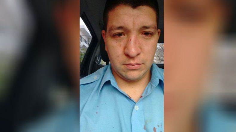 El cabo Orrego sufrió una fractura de tabique tras el enfrentamiento con los estatales.