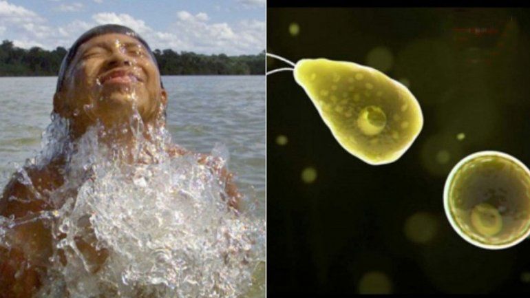ameba de agua dulce comecerebros