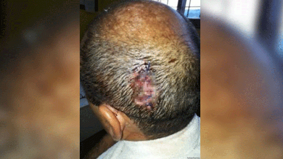 Apedrearon a un colectivero y se desmayó al volante