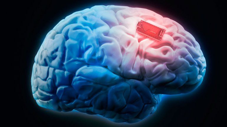 Un chip para manejar la compu con el cerebro | Tecnología