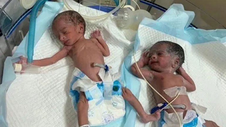 At 73, she gave birth to twins