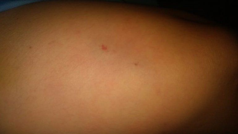 La joven policía fue atacada por dos perros pitbull.