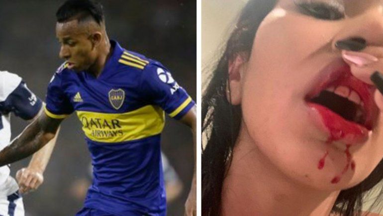 El jugador de Boca fue denunciado por su ex.