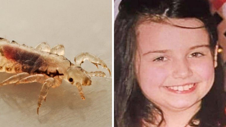 Los padres fueron acusados de asesinato por las pésimas condiciones en las que vivía la nena.