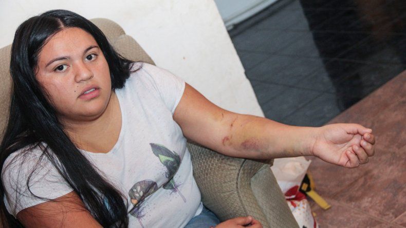 Candelaria fue brutalmente atacada por cuatro perros en el barrio Labraña, cuando salía rumbo a Neuquén para cursar en la Facultad de Ingeniería.