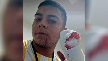 Violento ataque a un repartidor: le cortaron cuatro dedos para robarle la moto