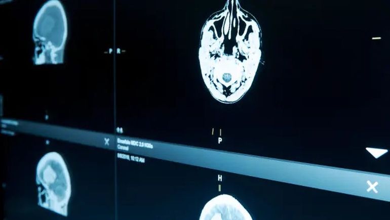 Científicos chinos logran importante avance. Científicos chinos logran importante avance.