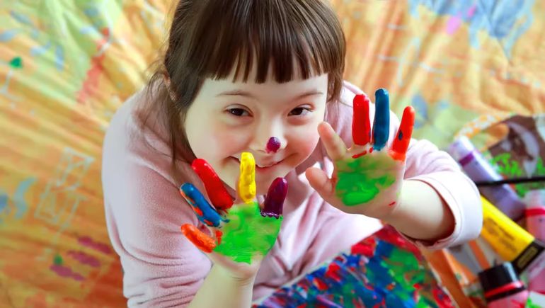 Día Mundial de las Personas con Síndrome de Down: tomar conciencia y asumir el desafío de la inclusión real