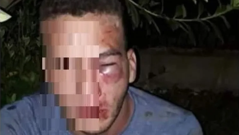 Pactó un encuentro con una nena y la familia de ella lo desfiguró