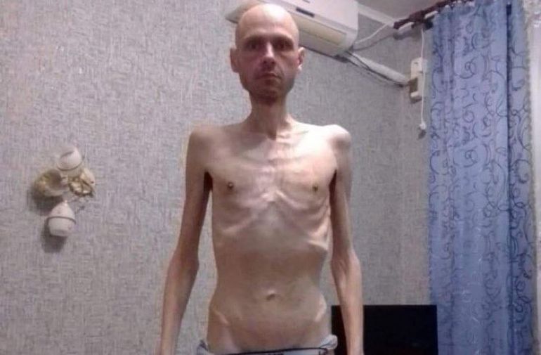 Volodimir Tsema Butsov, músico y ex soldado ucraniano. Volodimir Tsema Butsov, músico y ex soldado ucraniano.