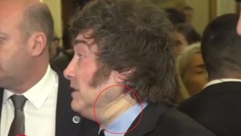 El misterio de la venda en el cuello: por qué apareció lesionado Javier Milei El misterio de la venda en el cuello: por qué apareció lesionado Javier Milei