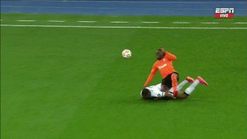 lo peor que vas a ver hoy: terrible lesion en la champions lo peor que vas a ver hoy: terrible lesion en la champions