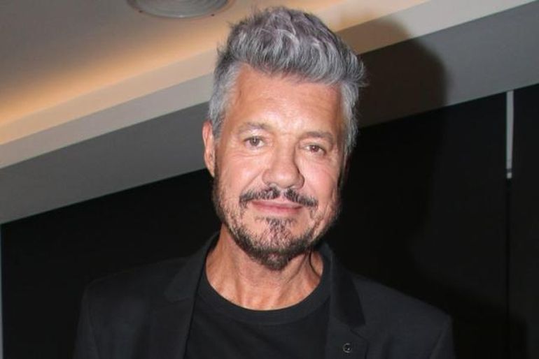 La foto: Marcelo Tinelli mostró cómo es su cara tras despertar