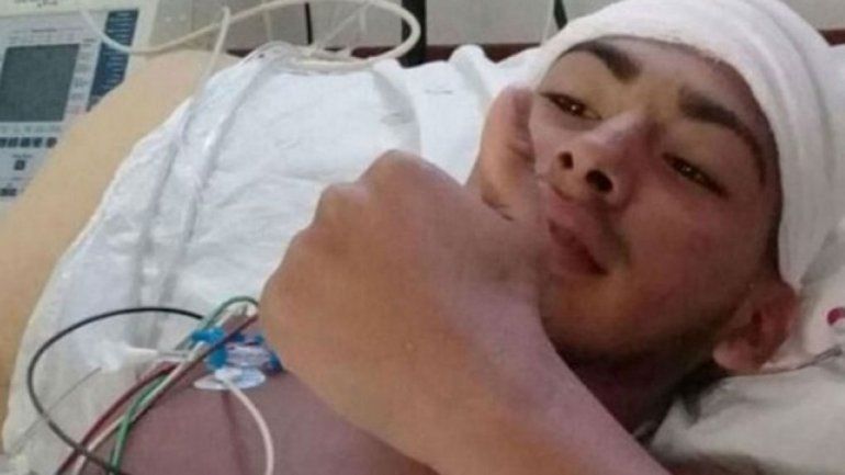 Un día después de la golpiza le advirtieron el coágulo y lo operaron.