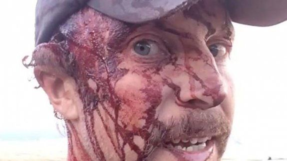 La osa estaba con sus crías y se abalanzó sobre Todd Orr, quien la roció con un spray para sacarse de encima a la bestia, pero fue como si nada: la osa lo atacó. ¡Y lo hizo dos veces!