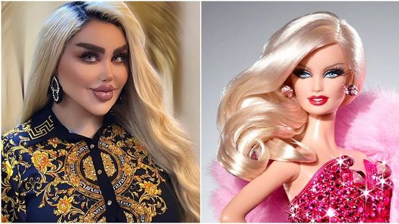 Así quedó la mujer que se hizo 43 cirugías estéticas para verse como Barbie