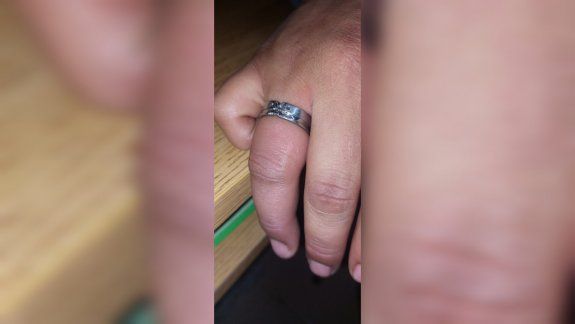 No hubo forma de sacarse el anillo y terminó en el cuartel de Bomberos