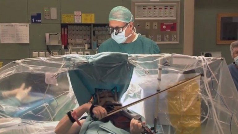 Video: tocó el violín mientras le sacaban un tumor cerebral