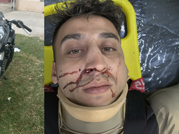 conocido futbolista y aguatero del pueblo choco los tambores de la ruta 65, sufrio heridas y la gente estallo conocido futbolista y aguatero del pueblo choco los tambores de la ruta 65, sufrio heridas y la gente estallo