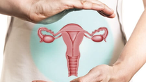 aconsejan controles regulares para prevenir el cancer de ovarios