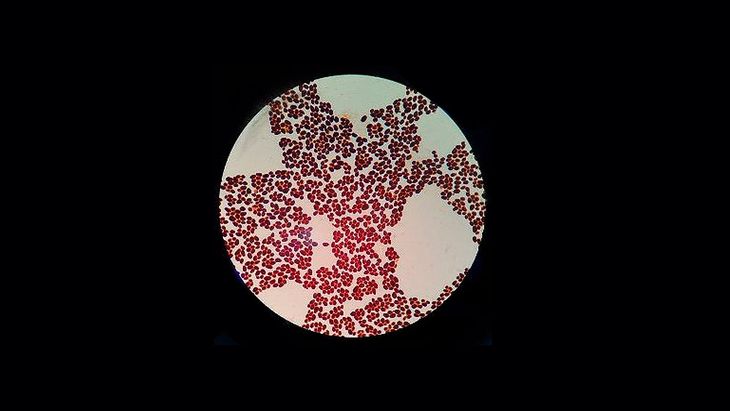 Las levaduras ganan terreno en el campo de los probióticos. Las levaduras ganan terreno en el campo de los probióticos.