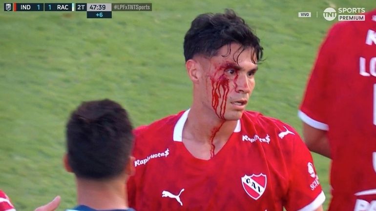 Galdames fue el protagonista de una polémica en el Independiente - Racing Galdames fue el protagonista de una polémica en el Independiente - Racing