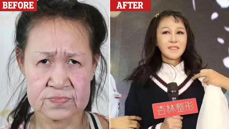 Se parecía a una mujer de 60 años y tenía 15