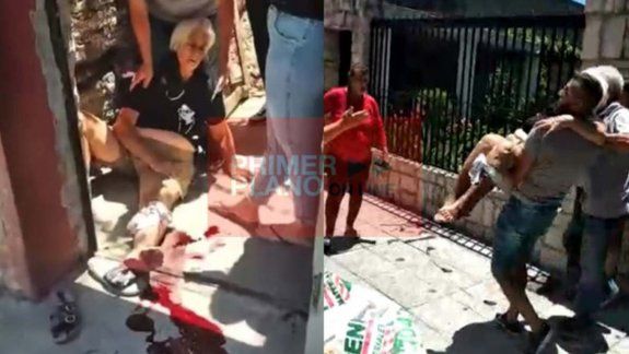 Video: salvaje ataque de una pitbull a una abuela