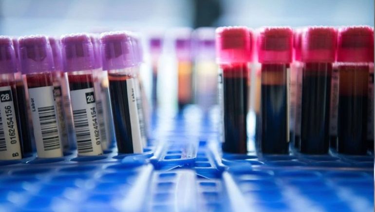 Solo una gotita de sangre: el test que permite detectar 50 tipos de cáncer