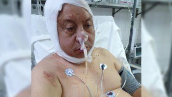 hombre-golpeado-plottier.jpg