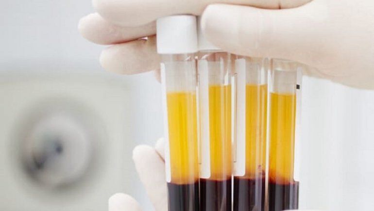 Europa es uno de los lugares donde más se promueve el uso de plasma contra el coronavirus.