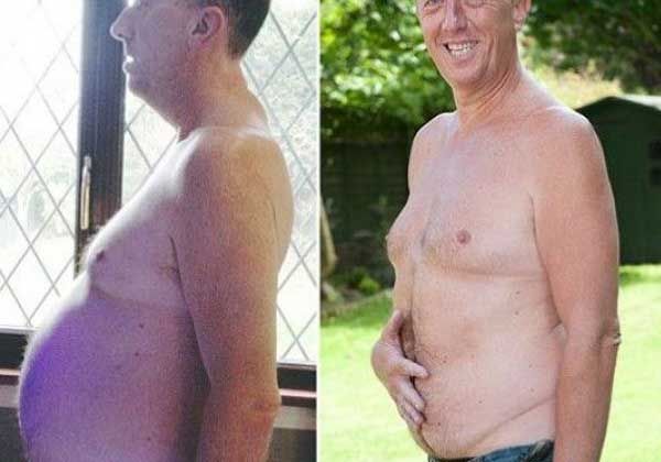 No era una panza cervecera, ¡era un tumor cancerígeno!