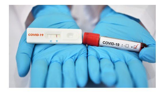 Casos de Covid-19 siguen aumentando en el mundo