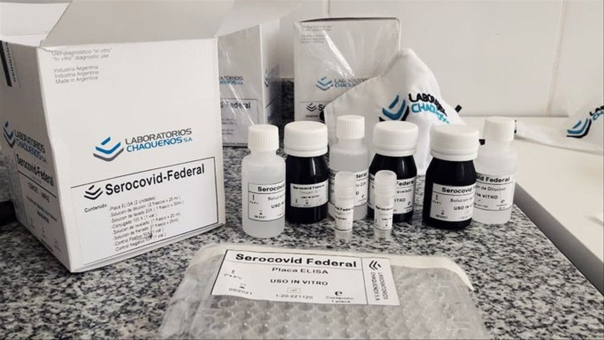 Covid: desarrollan un kit para detectar anticuerpos