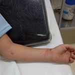 El nene debió ser internado. | LM Neuquen El nene debió ser internado.