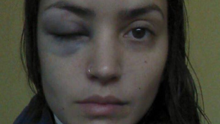 En la Policía le dijeron que no podían hacer nada.