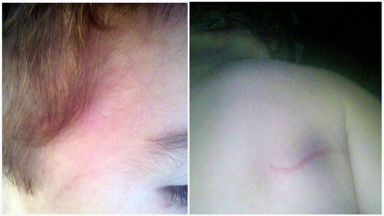 En nene de apenas 1 año y medio sufrió heridas leves.