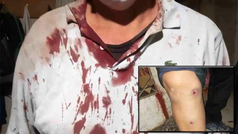 Denuncian que la Policía allanó una casa equivocada