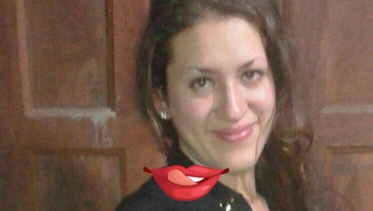 Se quemó la cara para que su novio celoso no le pegara