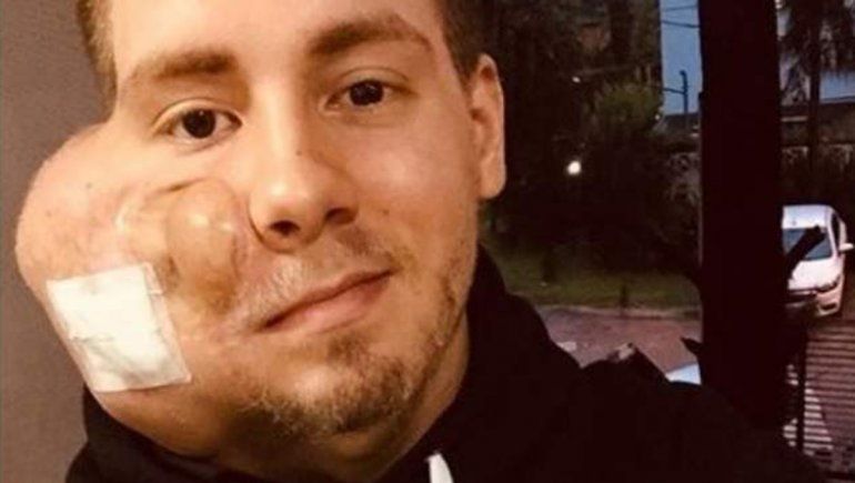 Lucha contra el cáncer: un joven necesita operarse en plena pandemia