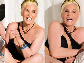 el misterioso tratamiento que rejuvenecio a susana gimenez que se volvio viral