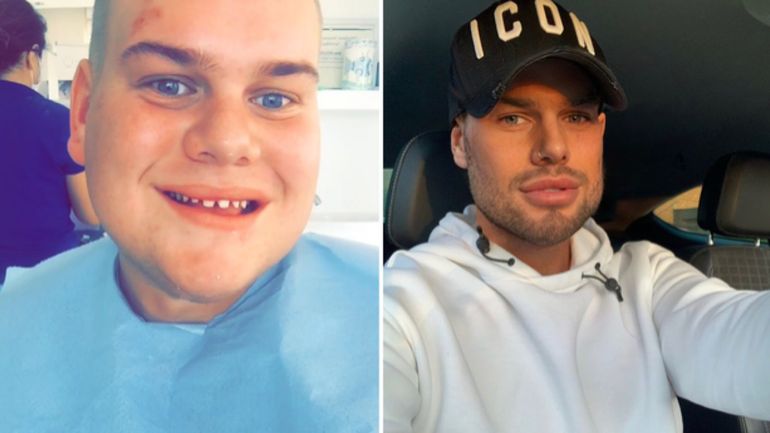 Gastó 35.000 dólares para ser perfecto en las redes