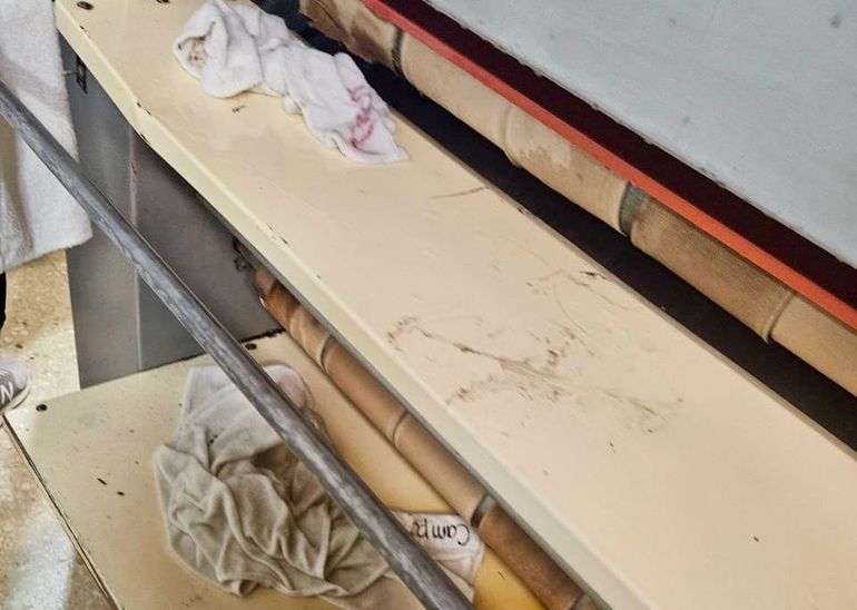 Accidente laboral en el hospital de Senillosa: van al paro porque se quemó con una plancha