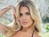 El drama que Camila Homs sufre en su cara