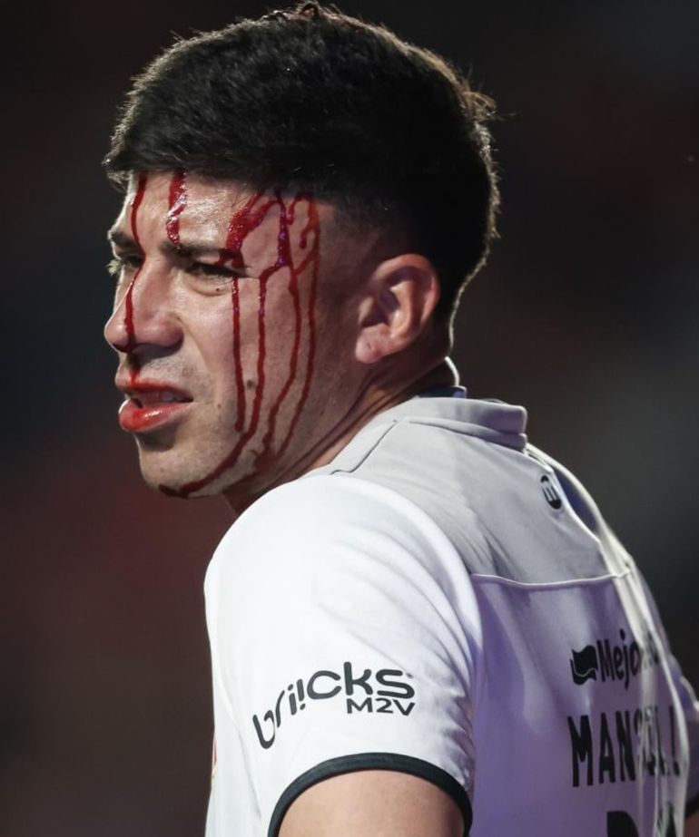 Así quedó Matías Mansilla tras el faul de San Lorenzo Así quedó Matías Mansilla tras el faul de San Lorenzo