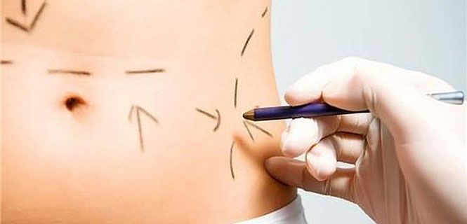 Buscan prohibir las cirugías estéticas en menores de 18 años