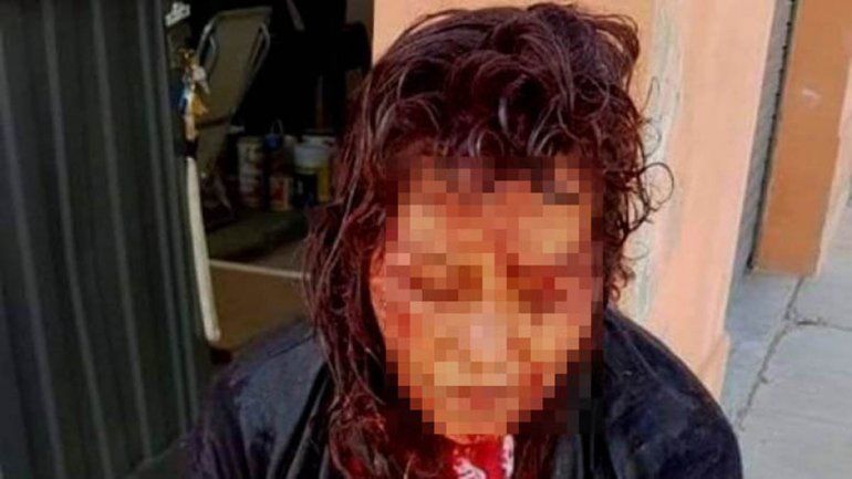 Dramático relato de la mujer que asistió a la turista violada en Puerto Deseado