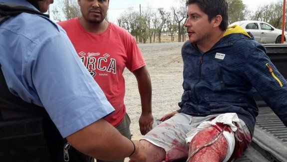 Lucas, el hijo del dueño del local, recibió una puñalada en una pierna.
