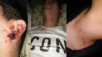 victimas de la golpiza no pudieron reconocer a sus atacantes victimas de la golpiza no pudieron reconocer a sus atacantes