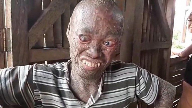 Antonio Reloj sufre un extraño mal que le pone la piel seca y escamosa. Soy un ser humano